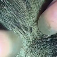 tickslice02