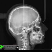 Sound image