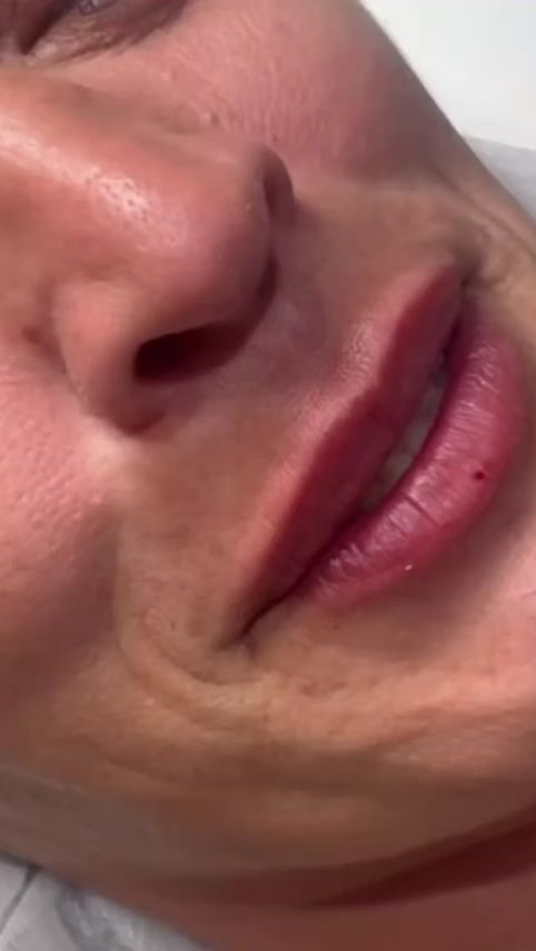 TikTok video thumbnail by skinbydrkelly