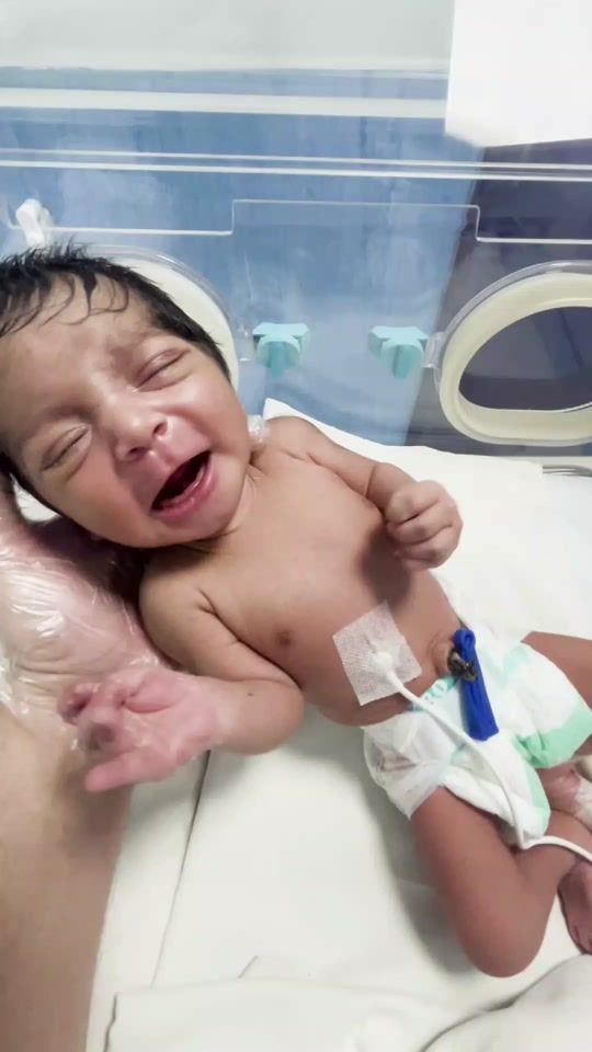 TikTok video thumbnail by borncuteebabies
