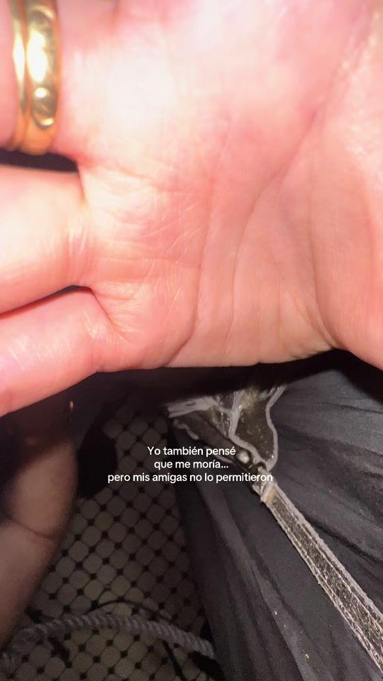 TikTok video thumbnail by marugoncaste