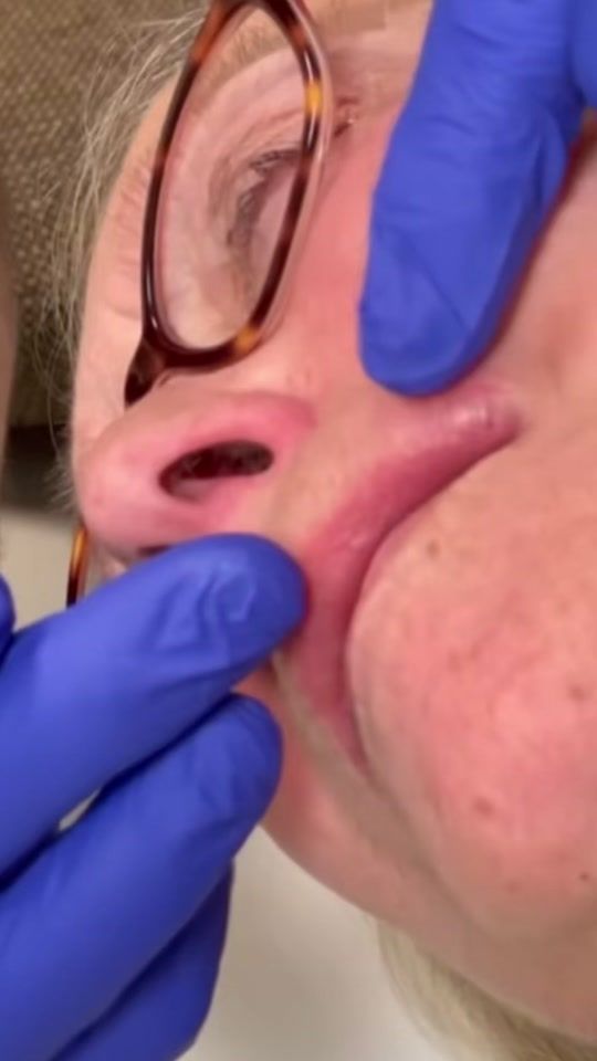 TikTok video thumbnail by pimple.concep