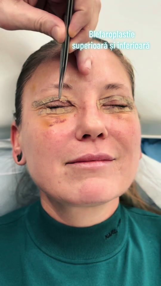 TikTok video thumbnail by dr.levymedicalcenter