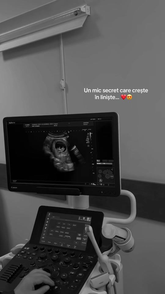 TikTok video thumbnail by cristinadurnea580