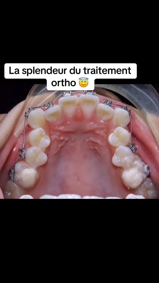 TikTok video thumbnail by votredentiste221