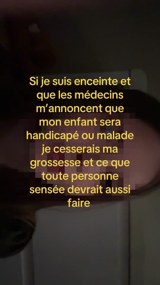 TikTok video thumbnail by ivo.rynx