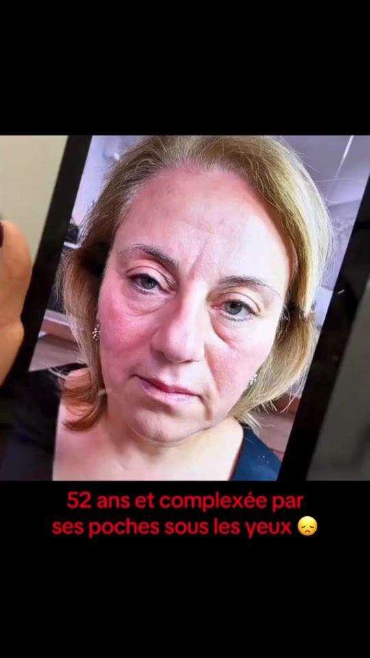 TikTok video thumbnail by licyanaskin