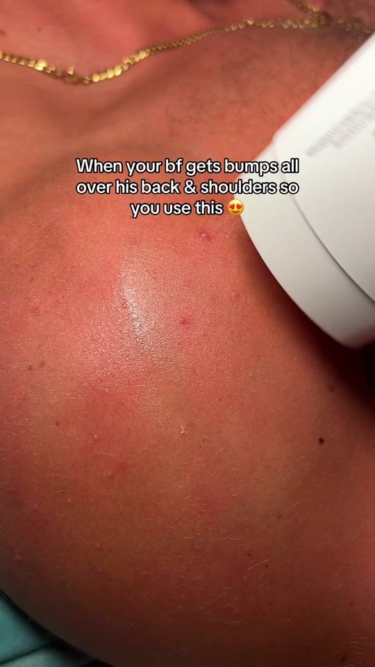 TikTok video thumbnail by daisreviews