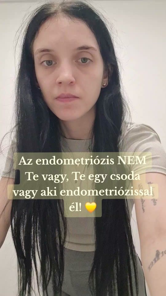 TikTok video thumbnail by timea529
