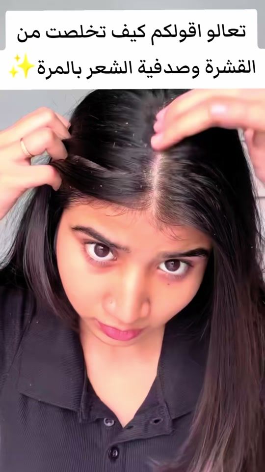 TikTok video thumbnail by youssefbio1