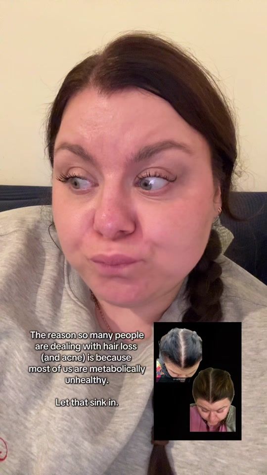 TikTok video thumbnail by healthy.hair.fairy