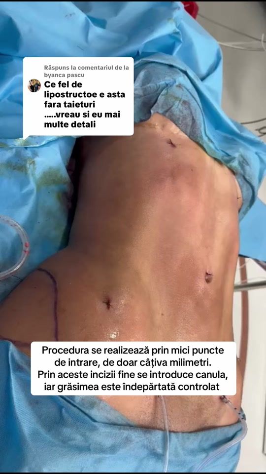 TikTok video thumbnail by legacy_med