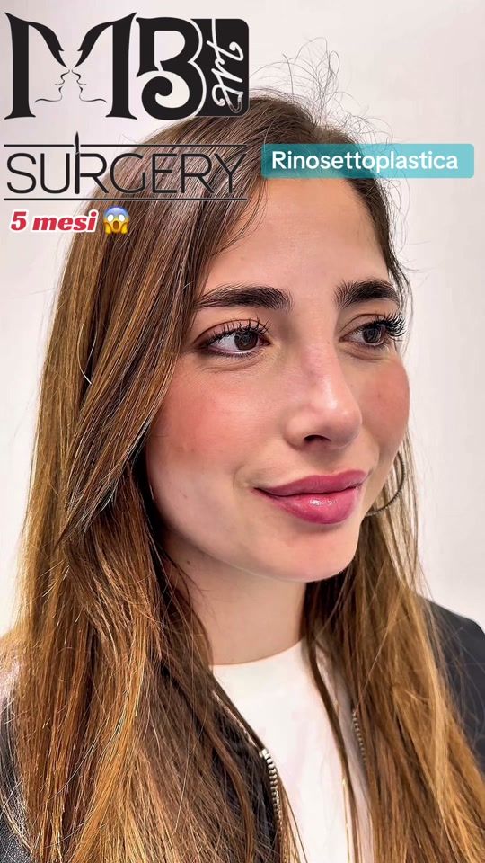 TikTok video thumbnail by brancaccio_matteo_dr