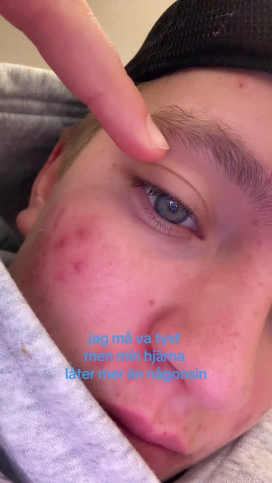 TikTok video thumbnail by fknbelmasbror