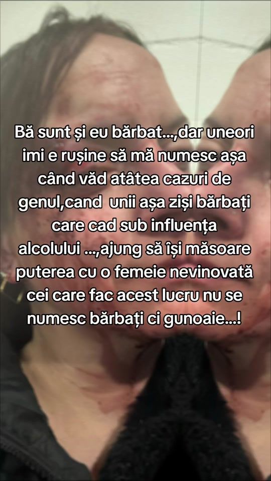 TikTok video thumbnail by catalinghiuta