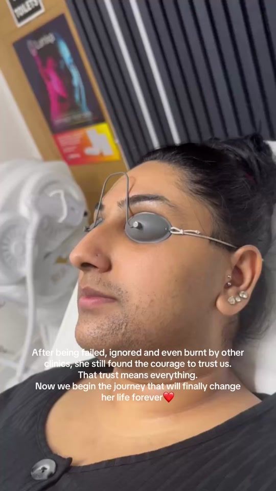 TikTok video thumbnail by rejuvalaser
