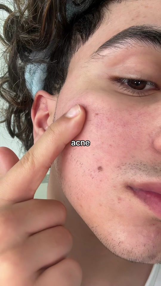 TikTok video thumbnail by glambyval