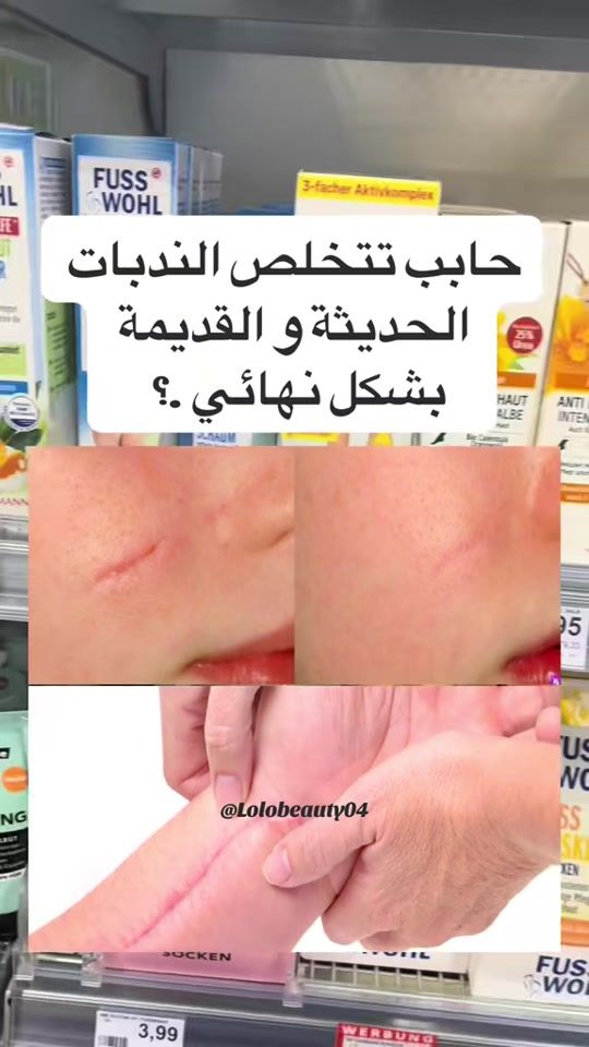 TikTok video thumbnail by lolobeauty04