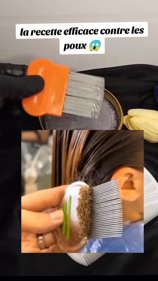 TikTok video thumbnail by docteurr.n