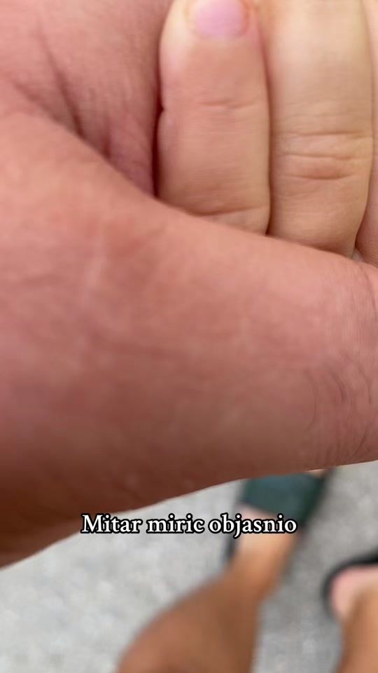 TikTok video thumbnail by hx88hx88