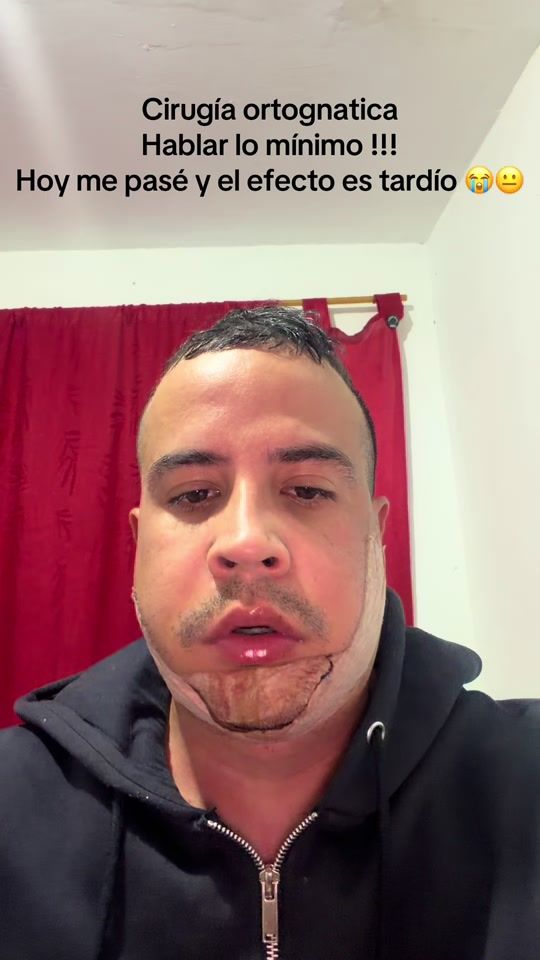 TikTok video thumbnail by franzh27